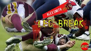 Video Highligts Alex Smith Leg Injury 2018 Youtube