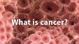 Hpv can cause cancers of the: What Is Cancer Forms Oncology Treatment Options Ctca
