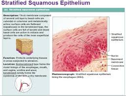 Pseudostratified columnar epithelium is a type of epithelium that appears to be stratified but instead consists of a single layer of irregularly shaped and differently sized columnar cells. Stratified Squamous Epithelium