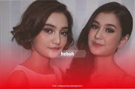 Intip Potret Laura Abbas Jackson Adik Zoe Jackson yang Tidak Kalah Cantik