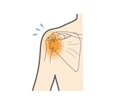 Image result for Rotator Cuff Injury