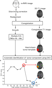 Schematic Flow Chart And The Illustrative Result Of Rs Fmri