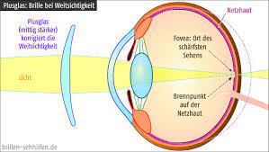 Positive Dioptriewerte Bei Weitsichtigkeit Dpt Pluswerte
