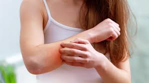 A psoríase é uma doença cutânea que faz com que pele fique com um tom vermelho e, na maioria dos casos, ela descasca. Saiba Tudo Sobre As Causas E Sintomas Da Psoriase Laboratorios Niam