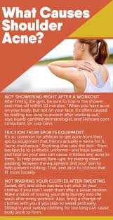 Discover What Are The Causes Of Shoulder Acne Shoulderacne Healthybeauty Https Myjeffreyjones Myshaklee Com Us E Shoulder Acne Healthy Beauty Acne Causes