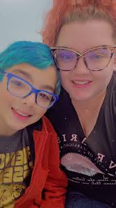 Giovanni has been to UMC last week for his first check up after surgery.,.  Surgeon was very satisfied with his recovery. Than came the option for a  second surgery. that was a