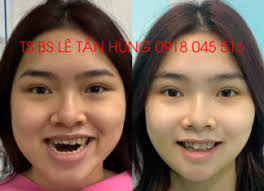 Thẩm mỹ viện Hùng Vương