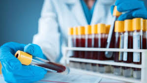 From 16 january 2021, all passengers arriving in. Mengenal Alur Periksa Rapid Test Covid 19 Dan Isolasi Mandiri