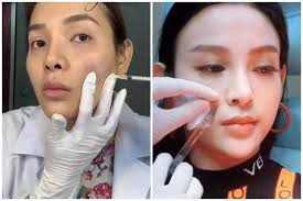 Jun 16, 2021 · ngày 16/6, công an huyện bảo thắng, tỉnh lào cai cho biết, đang tạm giữ chảo ông lố (31 tuổi, người địa phương) để điều tra về tội cưỡng đoạt tài. Huyá»n Baby PhÆ°Æ¡ng Trinh Jolie Cong Khai Tiem Filler Nhin Ná»•i Da Ga 2sao