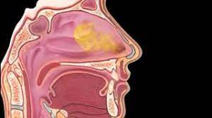Each tablet contains 10mg of. Loratadine Youtube