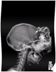 Infected X Ray Poster By Clarkarts24 The Last Of Us Edge Of The Universe X Ray