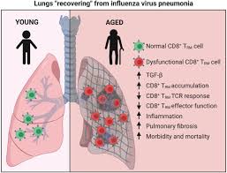 It can be mild or very serious. Seedy Cd8 T Rm Cells In Aging Lungs Drive Susceptibility To Pneumonia And Sequelae Cellular Molecular Immunology