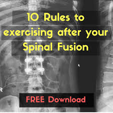 I Was On A Popular Spine Health Forum Talking With A Few People About Spinal Fusion And Reading Some Of The Spinal Fusion Spinal Fusion Surgery Spinal Surgery