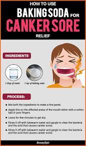 Baking Soda For Canker Sore Relief Effective Remedies To Try At Home Holistic Health Remedies Canker Sore Holistic Remedies