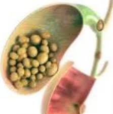 Magnetic resonance imaging (mri) or computerized tomography (ct). Is An 18 Mm Gall Bladder Stone Dangerous For The Body Quora