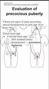 Image result for GnRH Stimulation Test