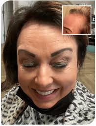 DHT Blocking Shampoo