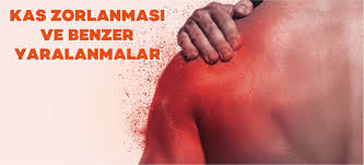 Kas Zorlanmasi Wellpoint