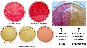 Macconkey Agar Composition Principle Uses Preparation