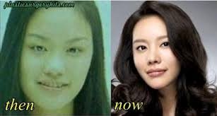 Top 5 Surprising Korean Plastic Surgery Plastic Surgery Kim Ah Joong Korean Plastic Surgery