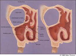 An olfactory region, consisting of the superior nasal concha and the opposed part of the septum, and a respiratory region the website can not function properly without these cookies. Functional Endoscopic Sinus Surgery American Family Physician
