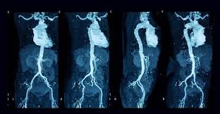 Image result for Incidental Imaging Finding