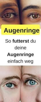 meine besten 7 hausmittel gegen augenringe augenringe entfernen augenringe hausmittel augenringe abdec augenringe hausmittel augenringe entfernen augenringe