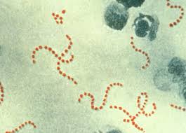 Image result for Group D Streptococcus
