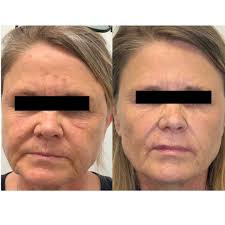 Epitomē Medical Aesthetics