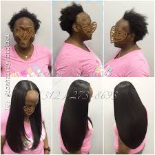 Do You Suffer From Traction Alopecia Loss Of Hair Due To Pulling On The Edges And Are Concerned Natural Hair Stylists Peinados Hair Styles Weave Hairstyles