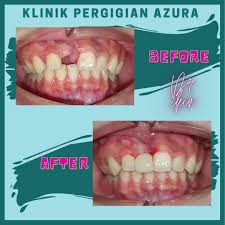 Klinik dr gigi asia (tampoi) (dentist, doctor, health) is located at no. Klinik Pergigian Azura Larkin Jb Home Facebook