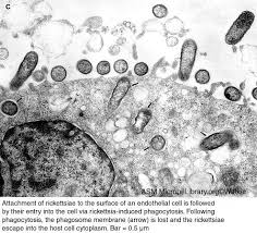 Image result for Rickettsiae