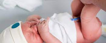 Dieser fällt normalerweise in den ersten zehn lebenstagen des säuglings ab. Nabelpflege Bei Neugeborenen Babys Tipps Anleitung