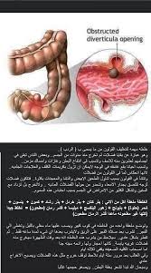 هل تعرف ما هو الردب خلطه مهمه لتنظيف القولون من ما يسمى ب الردب وهو عبارة عن بقايا فضلات لم تخرج منذ سن Health And Nutrition Body Health Health Advice