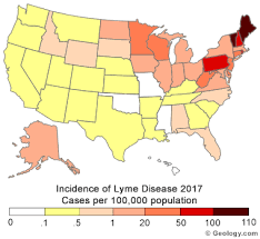 Tick Bites Lyme Disease Symptoms Tick Removal