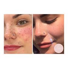 Here, read about freckle tattoos, the next big beauty trend. Healed Freckles I Love How Soft And Natural These Are Freckle Tattoos Are So Popular Right Now Book Your Tattooed Freckles Freckles Makeup Permanent Makeup