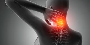 Image result for Syringomyelia