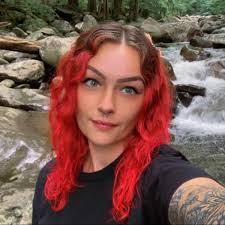 I burnt my butt cheeks surfing today 🥲😅😫