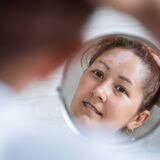 Advancements and Discoveries in Pigmentary Dermatology