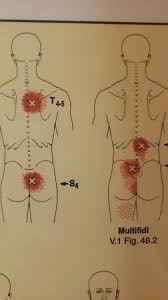 Image result for Trigger Point Location
