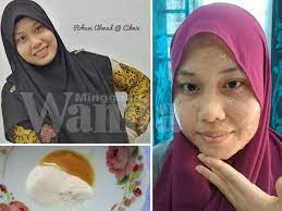 Jerawat adalah satu masalah kulit yang sering terjadi kepada semua kaum tidak kira kaum wanita atau kaum lelaki. Ada 5 Cara Lenyapkan Blackhead Dan Jerawat Guna Baking Soda Mingguan Wanita