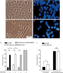 It is often positive for catalase and nitrate reduction and is a facultative anaerobe that can grow without the need for oxygen. Panton Valentine Leukocidin Pvl Positive Community Associated Download Scientific Diagram