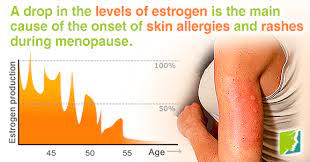 Pin On 34 Menopause Symptoms