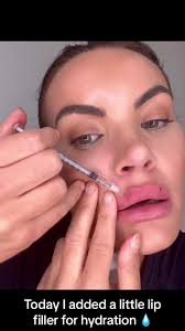 #lipfiller #doingmyownlipfillers #lipfilleronmyself #lips #lipfillerglasgow  #microdroplets #nofilteraesthetics #nofilteraestheticsglasgow #💉 #👄  #revolaxdeep