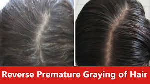 So, yoga does help in preventing or delaying the greying of hair. How To Reverse Premature Graying Of Hair Naturally Youtube