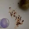 Loose and urgent bowel movements 1