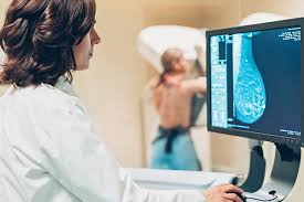 However, it may be necessary to take more images of each. Dense Breast Notification After Mammography Cdc