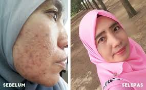 Penjagaan muka sebelum tidur itu juga sebenarnya penting. Kulit Muka Aset Anda Paling Berharga Jangan Salah Pilih Produk Kecantikan