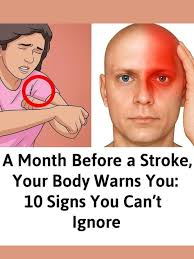 stroke warning signs to know
