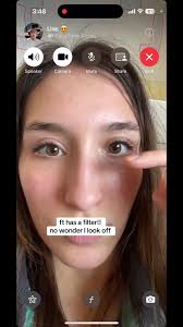 How to Get Rid of The Glow